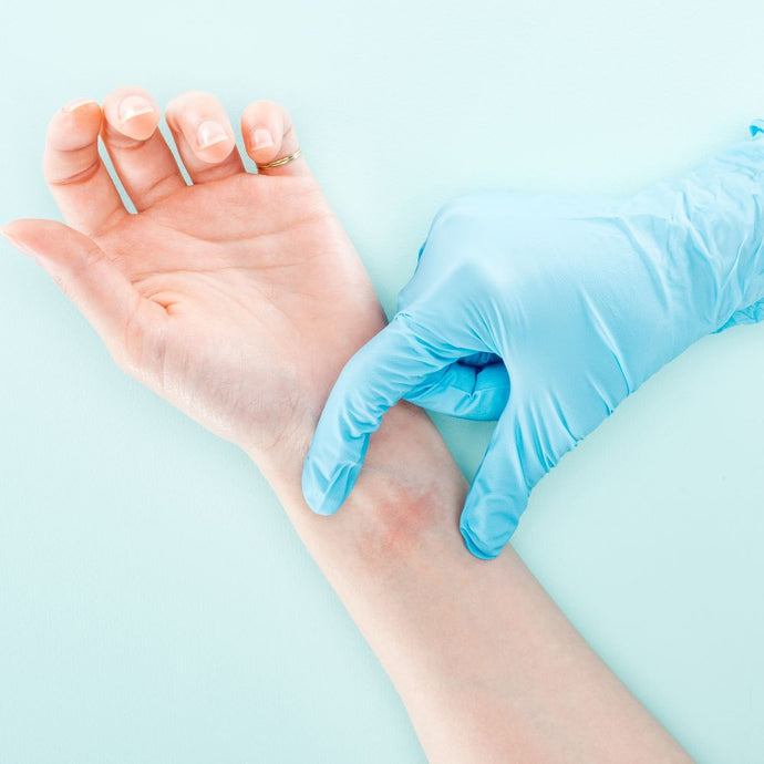 How To Prevent Allergic Reactions When Using Disposable Gloves